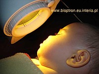 Bioptron, cykle bezpłatnych zabiegów
